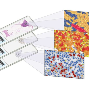 Digital Pathology